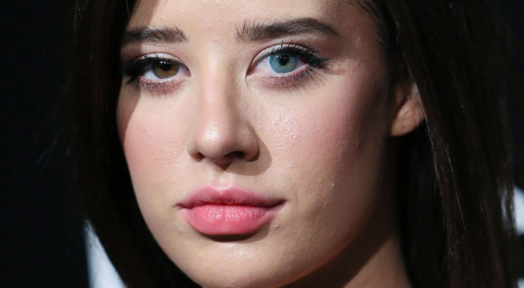 Famosos Que No Sabías Que Tienen Un Ojo De Cada Color