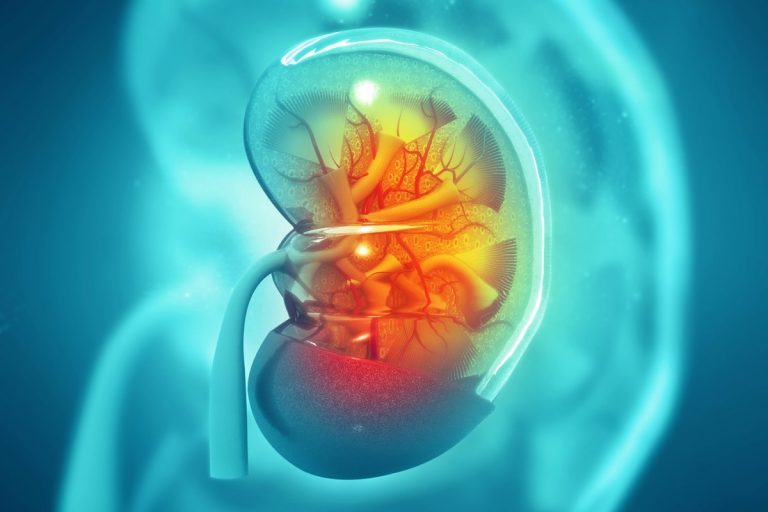 La innovación en los fármacos para el cáncer de riñón permiten prevenir la aparición de metástasis