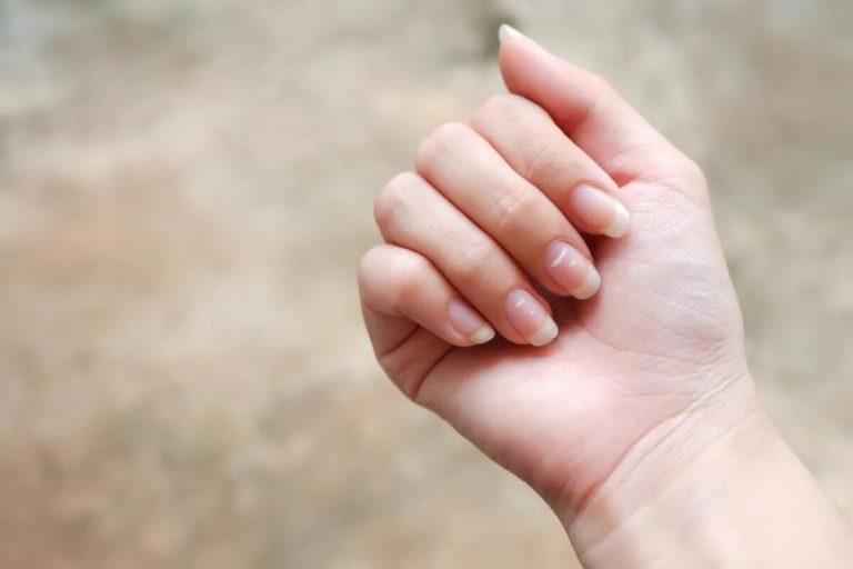 Esto es lo que significan las manchas blancas en las uñas