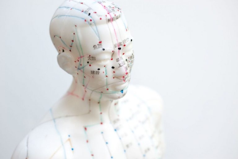Esta es la acupuntura que elimina el dolor en el cáncer
