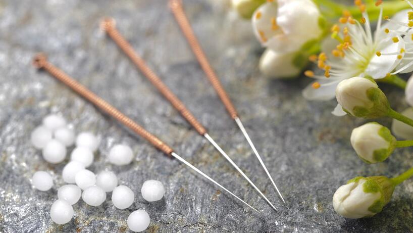 ¿Se Requiere De Preparación Para Aplicar La Acupuntura?
