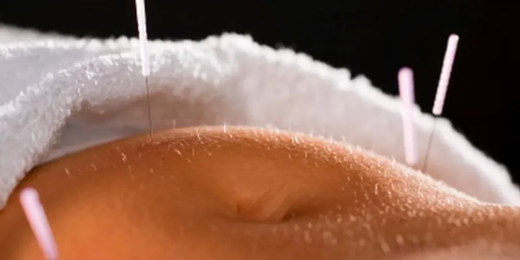 ¿La Acupuntura Permite Aliviar El Dolor Crónico Del Cáncer?