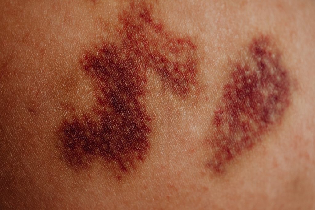 También Es Un Tema De Estética
