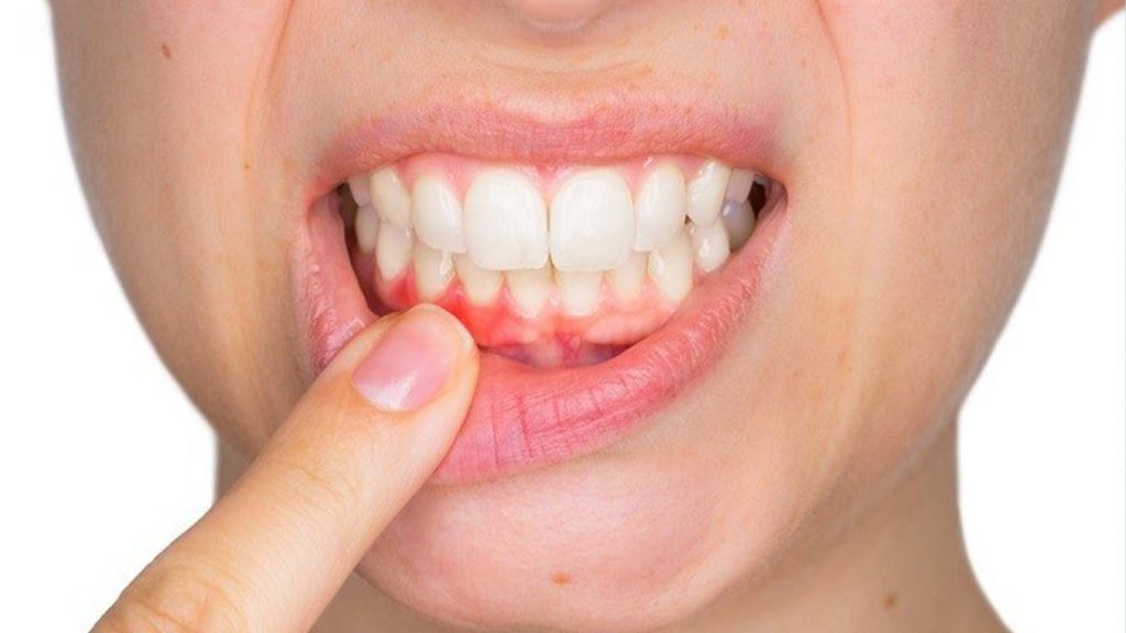 Distintos tratamientos para tus dientes