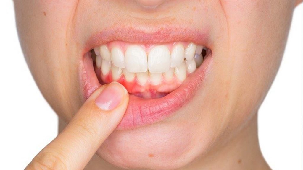 Distintos Tratamientos Para Tus Dientes