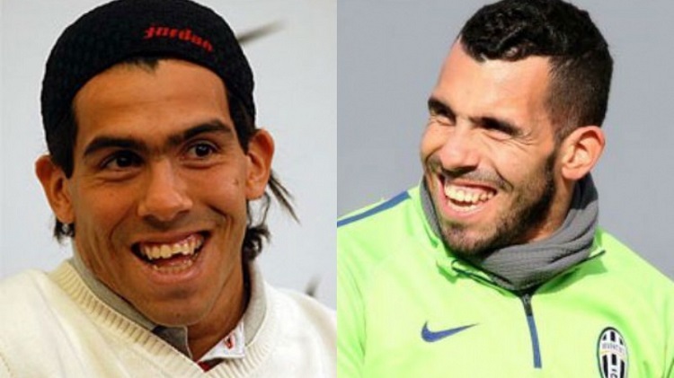 Famosos futbolistas con curiosas cirugías plásticas