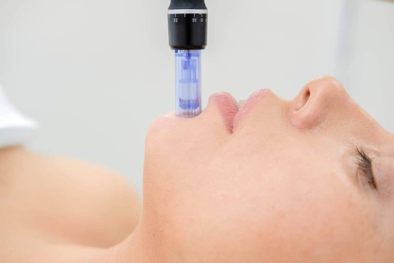 Preparar el rostro esta primavera con los tratamientos faciales de Policlinica ICD