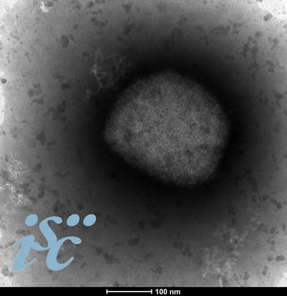 El ISCIII obtiene la secuencia completa del genoma del virus de la viruela del mono