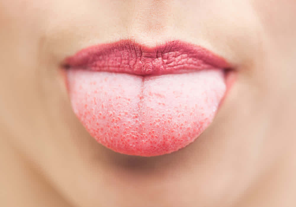 ¿Por qué es importante limpiarnos la lengua?