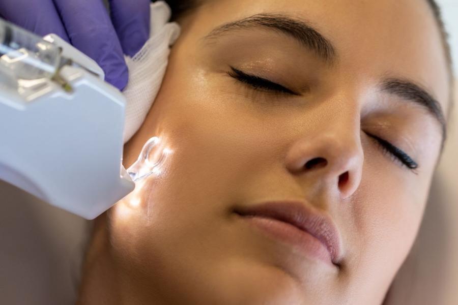 Peeling facial con un dermatólogo