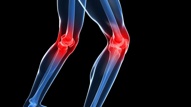 Los motivos por los que te duele la rodilla
