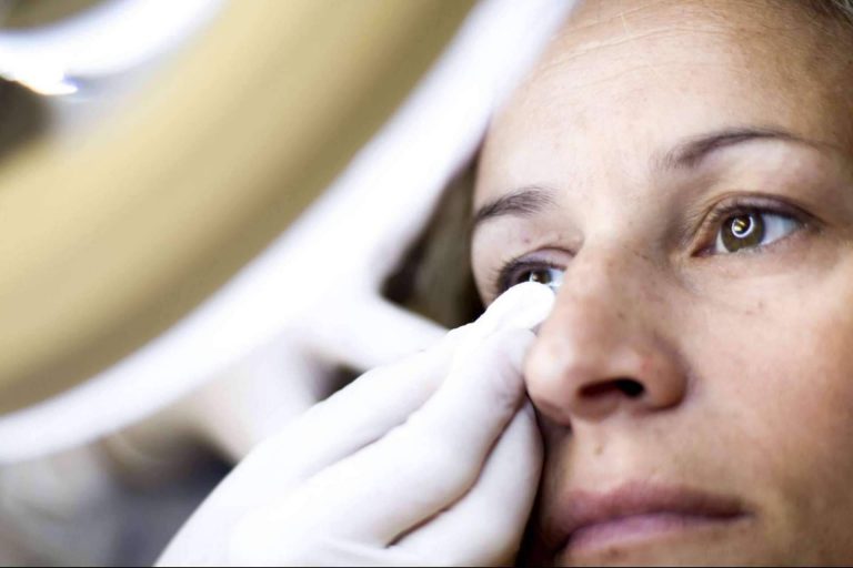 El síndrome del ojo seco, ¿qué tratamientos específicos existen?