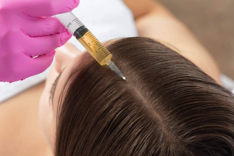 Plasma rico en plaquetas, mesoterapia capilar y vitaminas