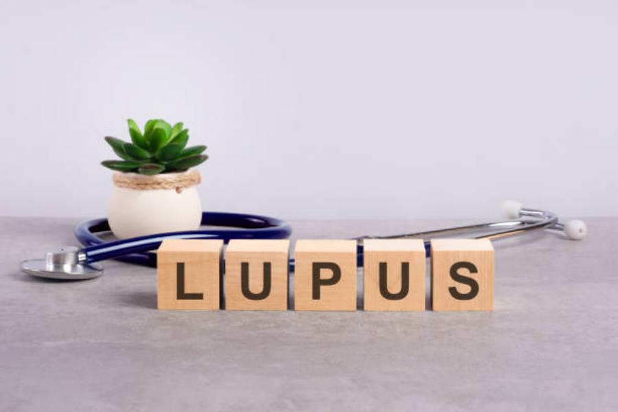 Quién está en riesgo de tener lupus