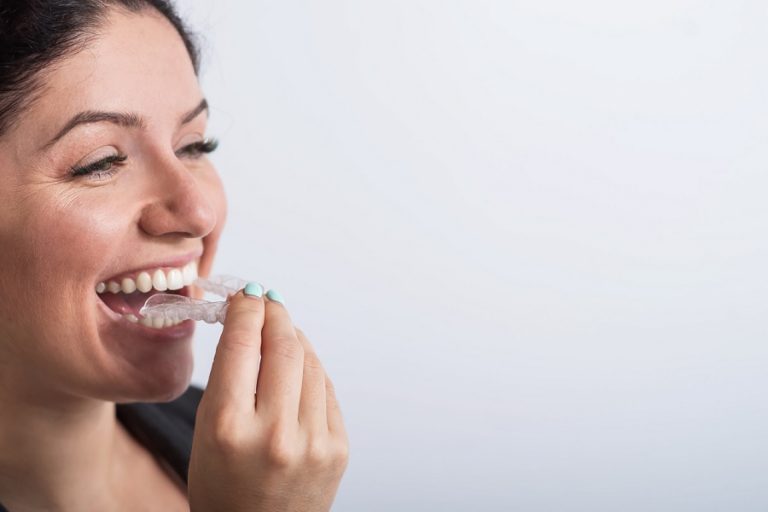¿Es realmente efectiva la ortodoncia invisible?