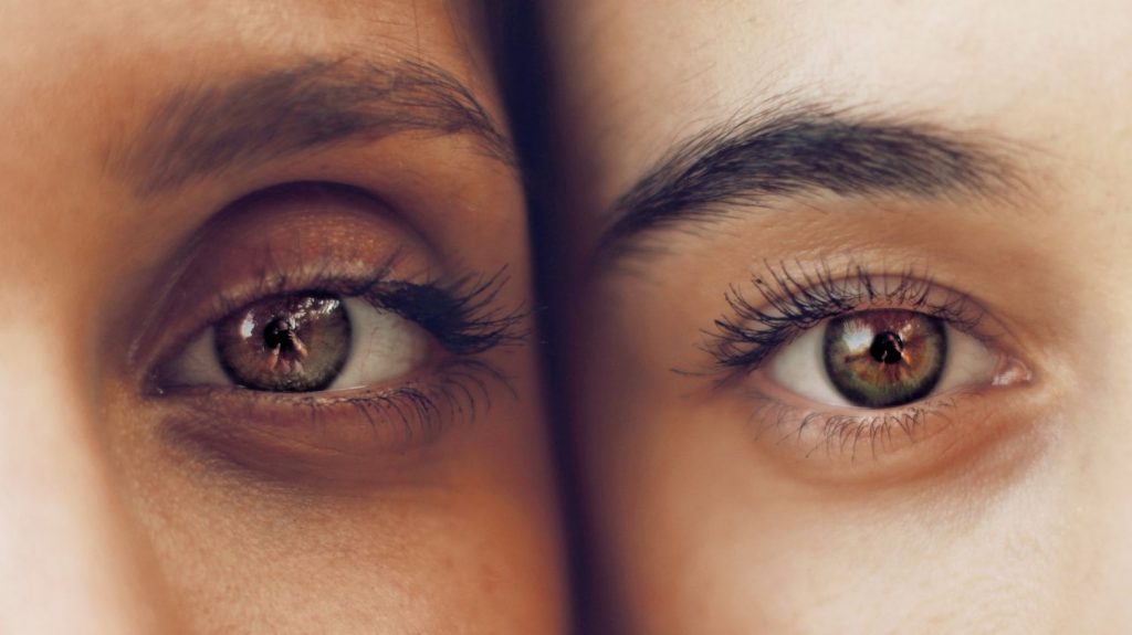 Remedio Natural Para Las Ojeras