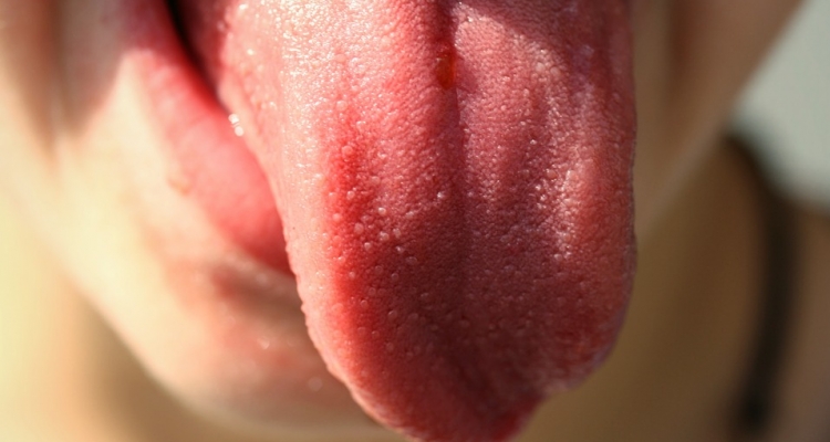 Lo que tu lengua dice de tu salud en imágenes