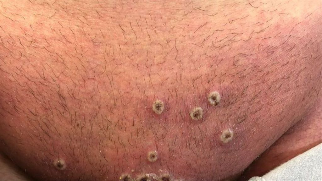 El Peligro De Una Nueva Pandemia