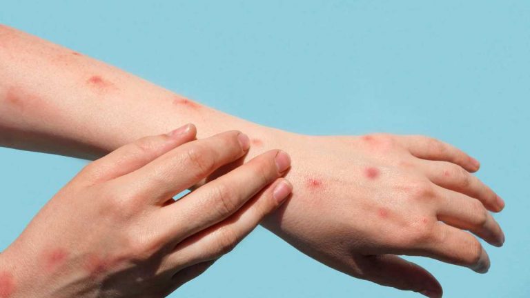La OMS confirma la llegada de una nueva pandemia: así será