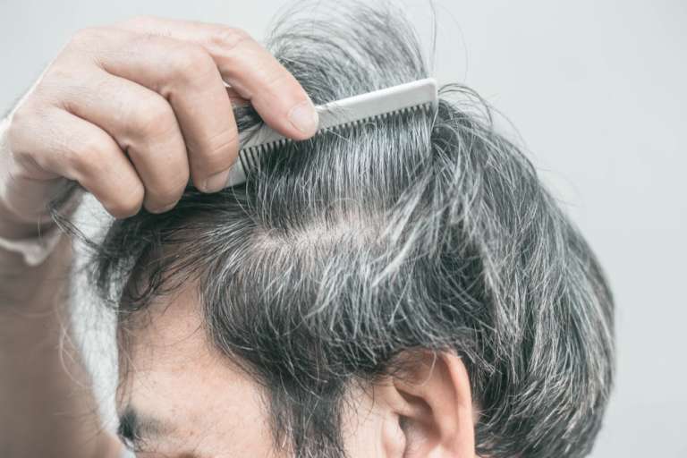¿Existe Algún Agente Que Salva De Las Canas?