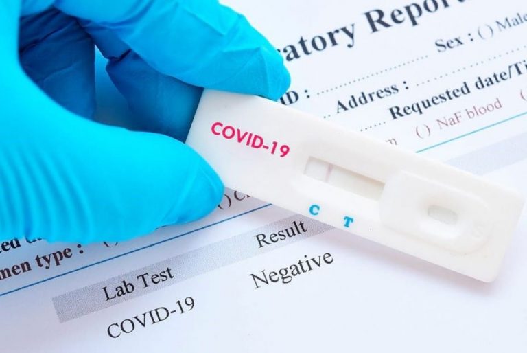 Pasos para hacer un test de antígenos fiable