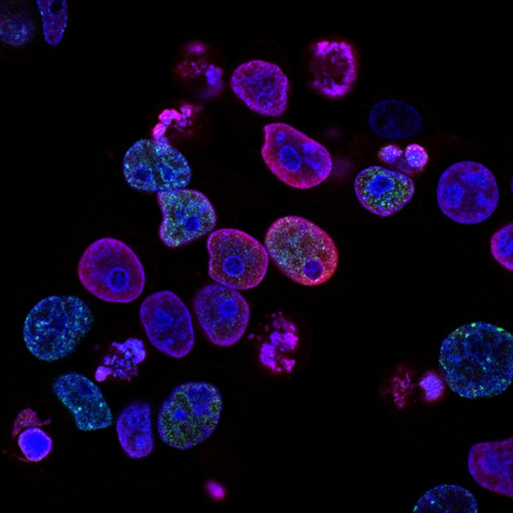 Estas Son Las Personas Más Propensas A Contraer Cáncer