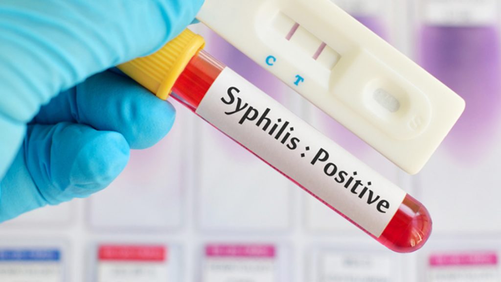 Sífilis