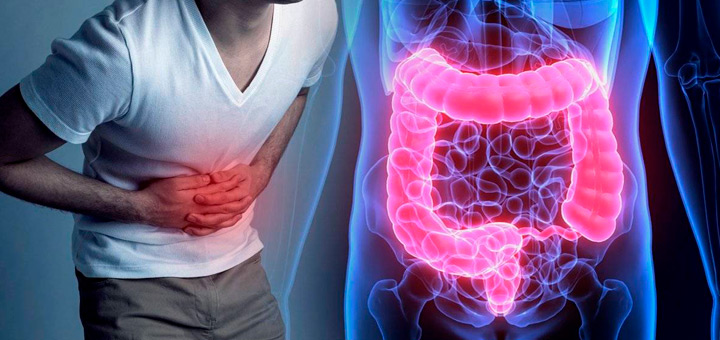 Causas De La Enfermedad De Crohn