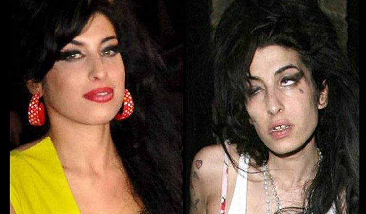 Fotos del antes y después de Amy Winehouse y otras famosas adictas a las drogas
