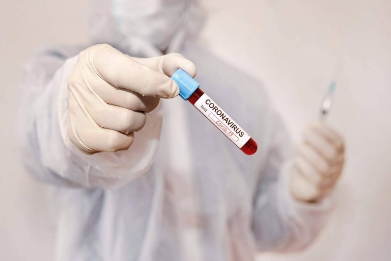 Diferentes pruebas de test covid en Madrid para viajar en verano, por Centro Médico Bravo