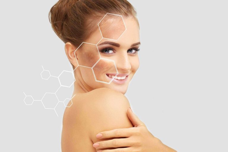 Clínica Femme y sus tratamientos de peeling en verano