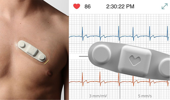 ¿Qué Es Un Parche Ecg?