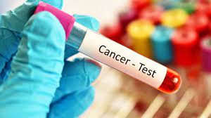¿Cómo Se Forma El Cáncer De Páncreas?