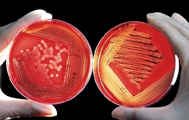 ¿Cómo Podemos Eliminar La Listeria?