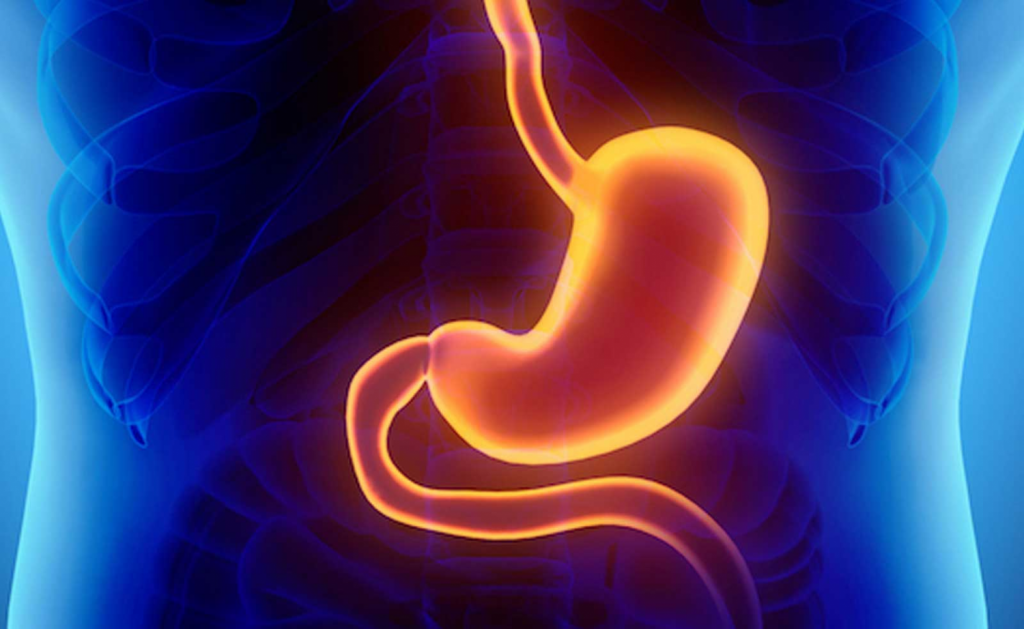 ¿Qué Es La Gastritis?