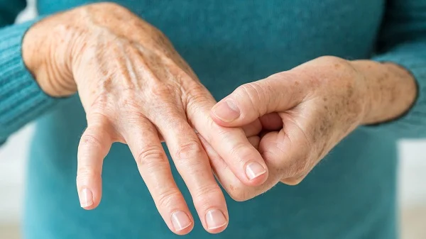 Artritis reumatoide. Señales que te avisan de que debes ir al médico YA