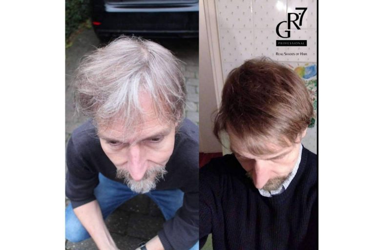 Restauración del color del cabello natural para disimular las canas con GR-7