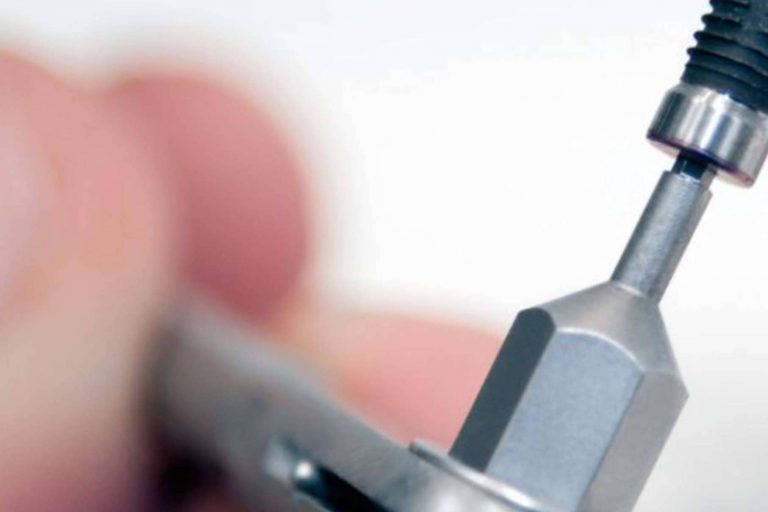 Implantes dentales en la clínica dental del Dr. Román Hernández para recuperar la funcionalidad de la boca
