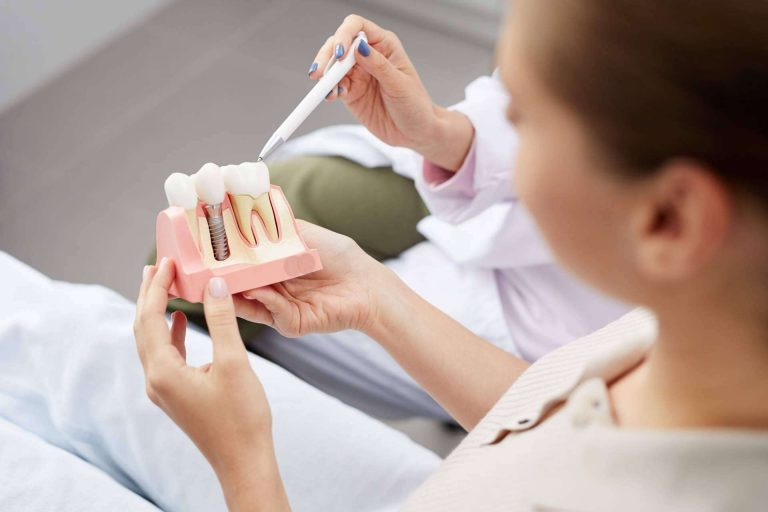 Calident permite disfrutar de una sonrisa sana y bonita gracias a sus implantes dentales
