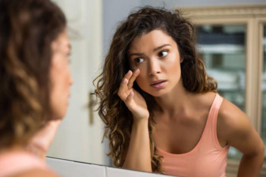 Tipos de ojeras