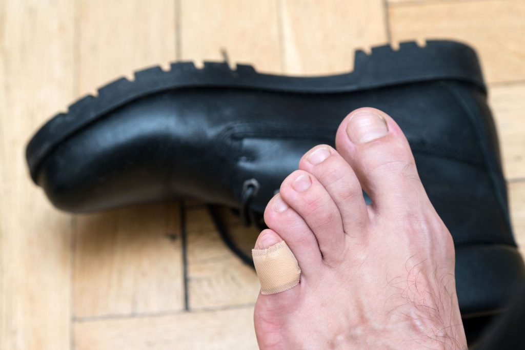 Ampollas en los pies: el truco para borrarlas en 24 horas 65 ¿Cómo prevenir la aparición de ampollas?