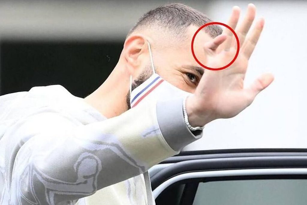 El dedo meñique que mostró Benzema 
