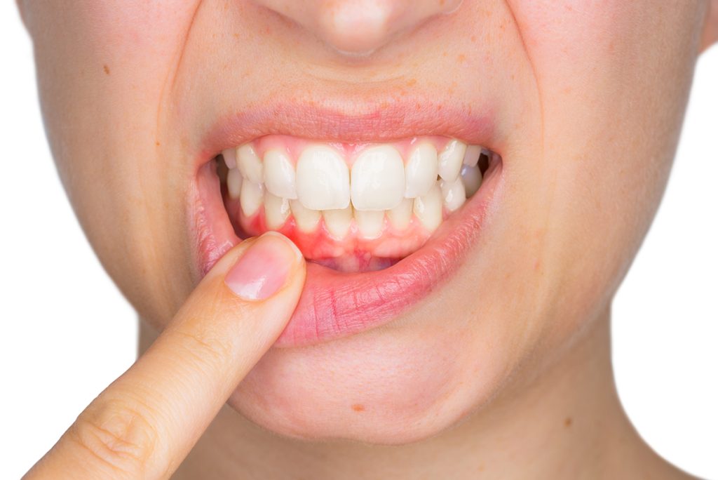Encias dientes