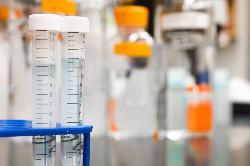 Los médicos realizan pruebas de laboratorio