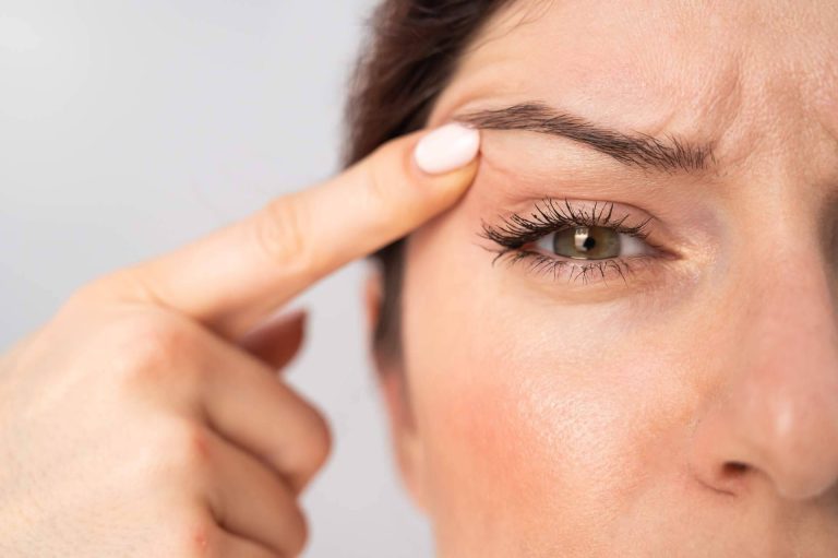 Alluring Clinic, ¿en qué consiste la blefaroplastia no quirúrgica?