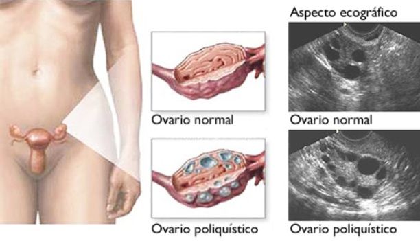 ¿Qué Más Hacen Los Ovarios?