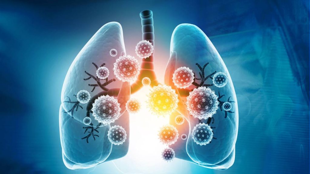 Metástasis Cáncer 