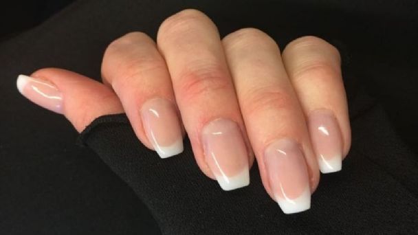 Algunas consecuencias del uso del esmalte en gel
