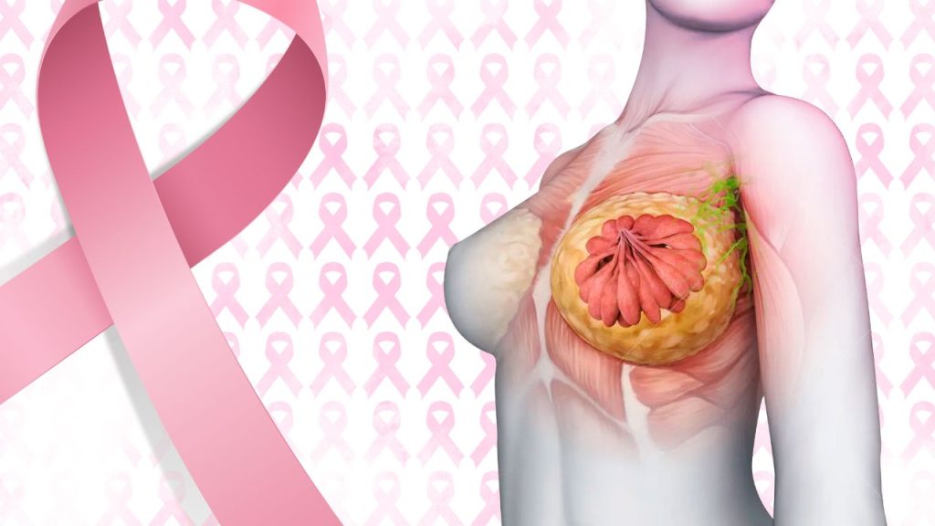 Combate Al Cáncer De Mama