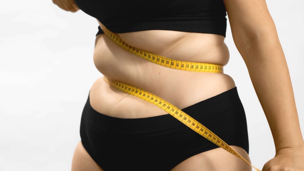 Obesidad Por Consumo De Azúcar